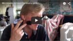 Craig's Facial Cancer