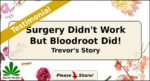 Trevor bloodroot