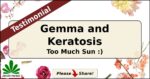 Gemma and Keratosis