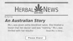 aus story