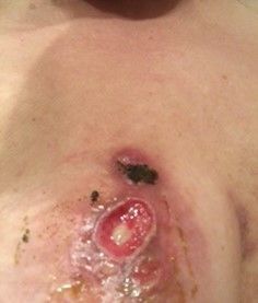 Image #2 from BK Zimmer